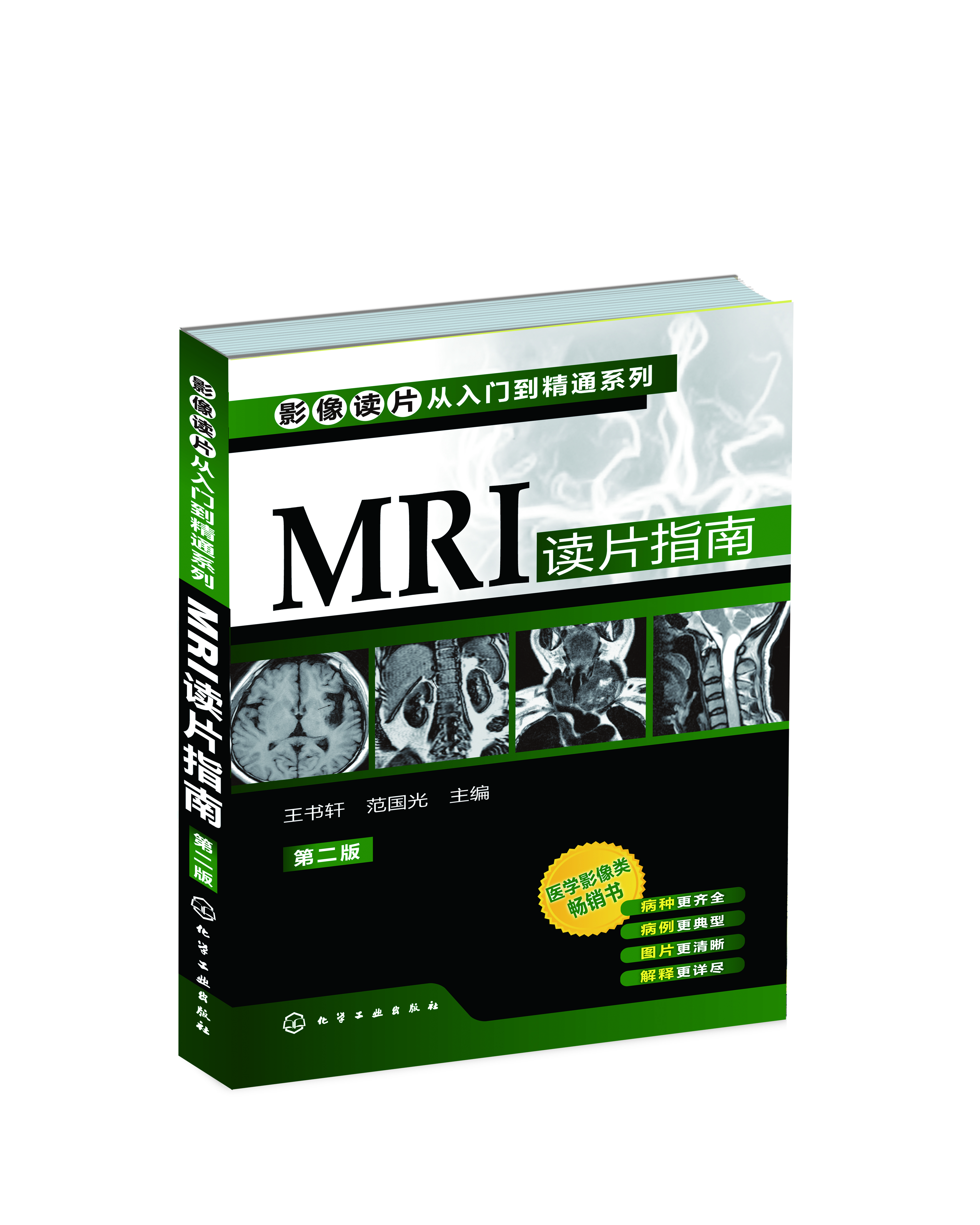 《MRI读片指南》